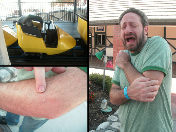 05 Bit by the Screamer.JPG